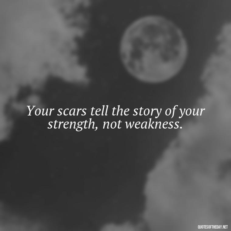 Your scars tell the story of your strength, not weakness. - Short Inspirational Tattoo Quotes