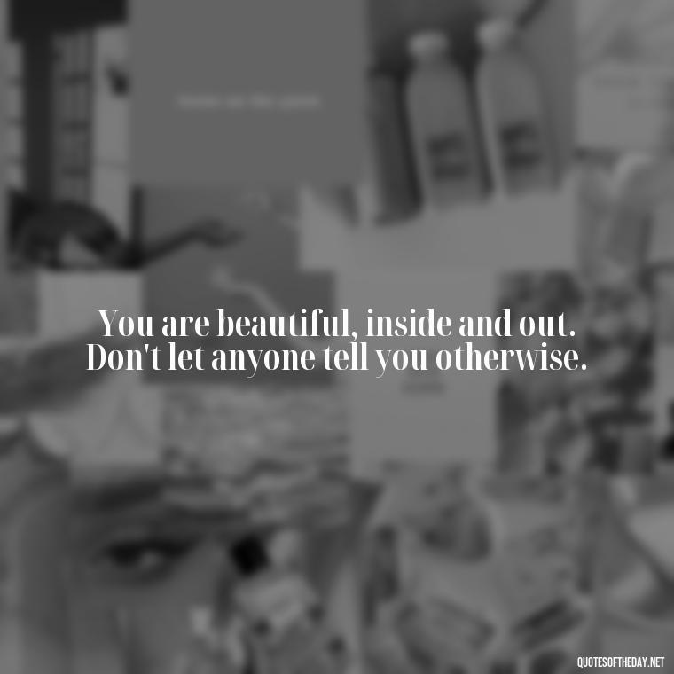 You are beautiful, inside and out. Don't let anyone tell you otherwise. - Cute Quotes About Self Love